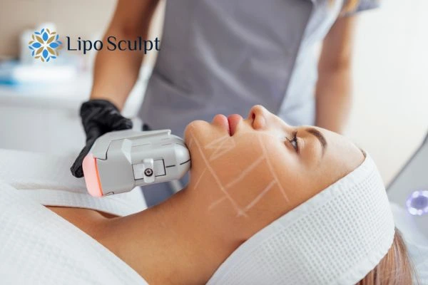 HIFU vs Botulinum Toxin: Understanding the Differences 1 HIFU vs Botox Tring What is the best option for you?