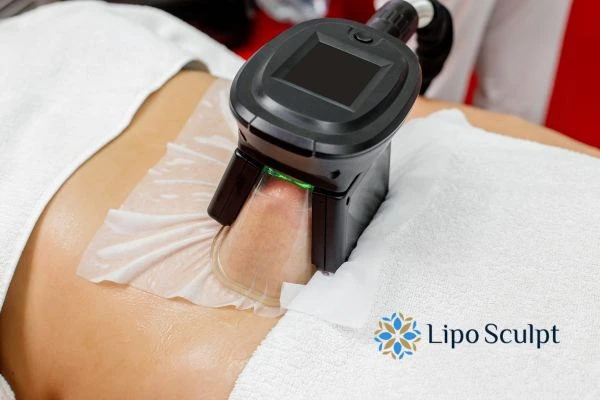 Does Fat Freezing at Home Work? DIY Devices vs Professional Cryolipolysis 1 How is professional cryolipolysis different Tring?