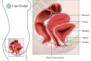 Treatment For A Leaky Bladder 2 How EM Chair treatment Tring can help Leaky bladder issues. Read more now!