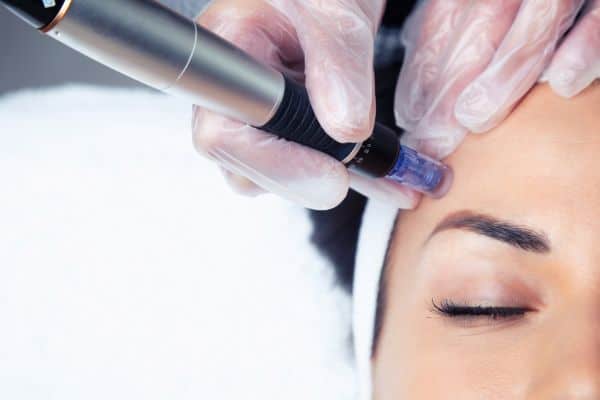 Explaining Total Skin Tightening Treatment and What to Expect 2 What Skin Concerns Can Total Skin Tightening Treatment Help With Tring?